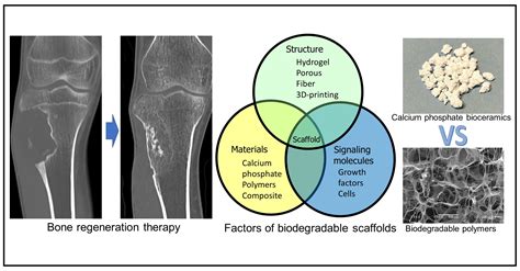  Justifying the Use of Juglone-Modified Bioceramics for Innovative Bone Regeneration!